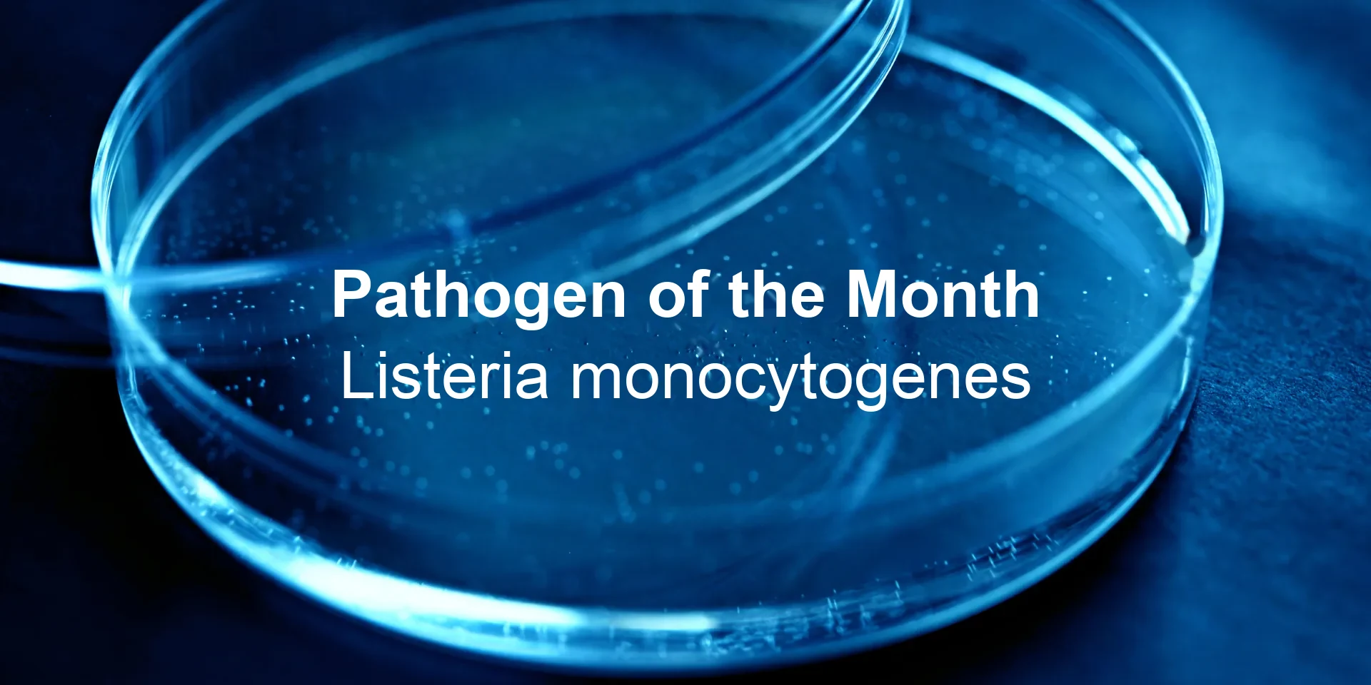 Pathogen of the Month: Listeria monocytogenes